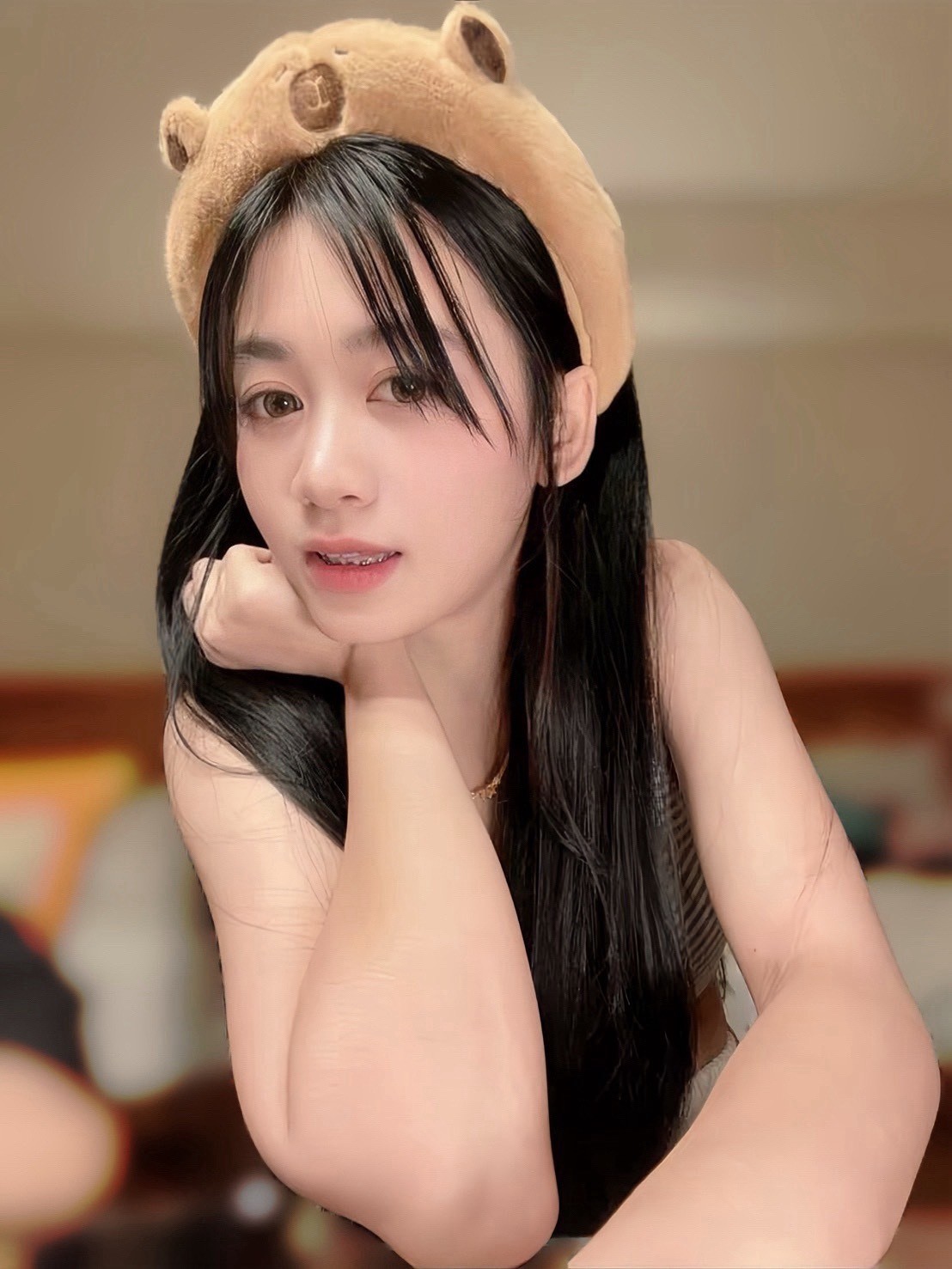 芽芽